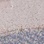 USP30 Antibody in Immunohistochemistry (Paraffin) (IHC (P))