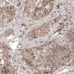 USP30 Antibody in Immunohistochemistry (Paraffin) (IHC (P))