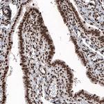 Histone H2B Antibody in Immunohistochemistry (Paraffin) (IHC (P))