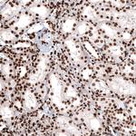 Histone H2B Antibody in Immunohistochemistry (Paraffin) (IHC (P))