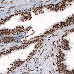 Histone H2B Antibody in Immunohistochemistry (Paraffin) (IHC (P))