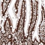 Histone H2B Antibody in Immunohistochemistry (Paraffin) (IHC (P))