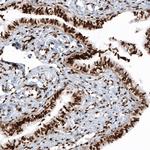 Histone H2B Antibody in Immunohistochemistry (Paraffin) (IHC (P))