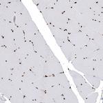 Histone H2B Antibody in Immunohistochemistry (Paraffin) (IHC (P))