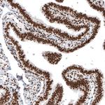 Histone Macro-H2A.1 Antibody in Immunohistochemistry (Paraffin) (IHC (P))