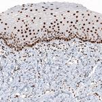 Histone Macro-H2A.1 Antibody in Immunohistochemistry (Paraffin) (IHC (P))