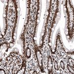 Histone Macro-H2A.1 Antibody in Immunohistochemistry (Paraffin) (IHC (P))