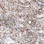 Histone Macro-H2A.1 Antibody in Immunohistochemistry (Paraffin) (IHC (P))