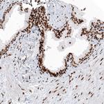 Histone Macro-H2A.1 Antibody in Immunohistochemistry (Paraffin) (IHC (P))