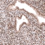 CUX1 Antibody in Immunohistochemistry (Paraffin) (IHC (P))