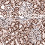 CUX1 Antibody in Immunohistochemistry (Paraffin) (IHC (P))