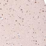 CUX1 Antibody in Immunohistochemistry (Paraffin) (IHC (P))