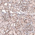 CUX1 Antibody in Immunohistochemistry (Paraffin) (IHC (P))