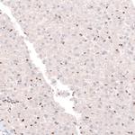 CUX1 Antibody in Immunohistochemistry (Paraffin) (IHC (P))