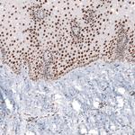 CUX1 Antibody in Immunohistochemistry (Paraffin) (IHC (P))