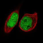 FOXP2 Antibody in Immunocytochemistry (ICC/IF)