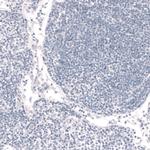 FOXP2 Antibody in Immunohistochemistry (Paraffin) (IHC (P))