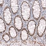 FOXP2 Antibody in Immunohistochemistry (Paraffin) (IHC (P))