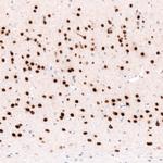 FOXP2 Antibody in Immunohistochemistry (Paraffin) (IHC (P))