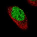 FOXP2 Antibody in Immunocytochemistry (ICC/IF)