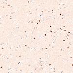 FOXP2 Antibody in Immunohistochemistry (Paraffin) (IHC (P))