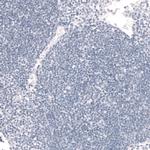 FOXP2 Antibody in Immunohistochemistry (Paraffin) (IHC (P))