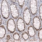 FOXP2 Antibody in Immunohistochemistry (Paraffin) (IHC (P))