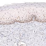 FOXP2 Antibody in Immunohistochemistry (Paraffin) (IHC (P))