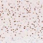 FOXP2 Antibody in Immunohistochemistry (Paraffin) (IHC (P))