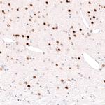 FOXP2 Antibody in Immunohistochemistry (Paraffin) (IHC (P))