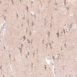 CTGF Antibody in Immunohistochemistry (Paraffin) (IHC (P))