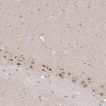 CTGF Antibody in Immunohistochemistry (Paraffin) (IHC (P))