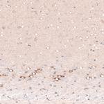 CTGF Antibody in Immunohistochemistry (Paraffin) (IHC (P))