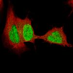 SOX4 Antibody in Immunocytochemistry (ICC/IF)