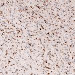 SOX4 Antibody in Immunohistochemistry (Paraffin) (IHC (P))