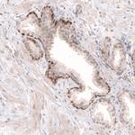 SOX4 Antibody in Immunohistochemistry (Paraffin) (IHC (P))