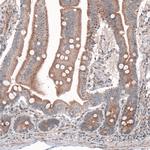 G6PC Antibody in Immunohistochemistry (Paraffin) (IHC (P))