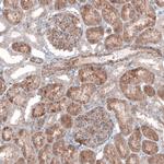 G6PC Antibody in Immunohistochemistry (Paraffin) (IHC (P))