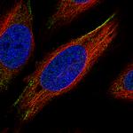 ROR2 Antibody in Immunocytochemistry (ICC/IF)