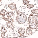 ROR2 Antibody in Immunohistochemistry (Paraffin) (IHC (P))