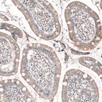 ROR2 Antibody in Immunohistochemistry (Paraffin) (IHC (P))