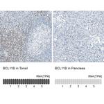 BCL11B Antibody