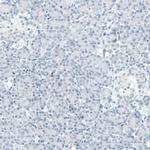 BCL11B Antibody in Immunohistochemistry (Paraffin) (IHC (P))