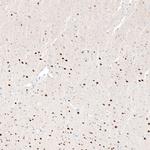 BCL11B Antibody in Immunohistochemistry (Paraffin) (IHC (P))