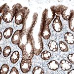 ITGA3 Antibody in Immunohistochemistry (Paraffin) (IHC (P))