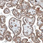 ITGA3 Antibody in Immunohistochemistry (Paraffin) (IHC (P))