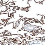 ITGA8 Antibody in Immunohistochemistry (Paraffin) (IHC (P))