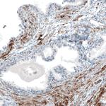 ITGA8 Antibody in Immunohistochemistry (Paraffin) (IHC (P))