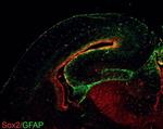 SOX2 Antibody in Immunohistochemistry (Frozen) (IHC (F))