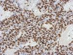 OCT4 Antibody in Immunohistochemistry (Paraffin) (IHC (P))